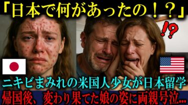 【海外の反応】「日本で何をされたの…？」ニキビだらけのアメリカ人少女が日本留学から帰国後、両親が号泣した衝撃の理由